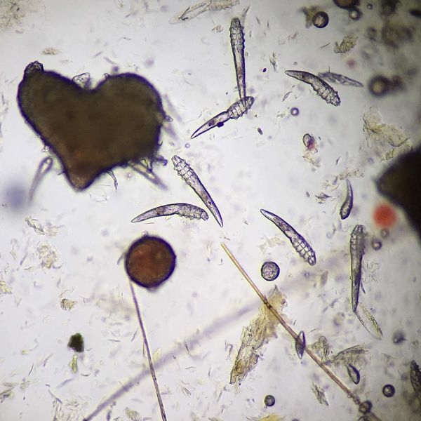 Demodex canis from a skin scrape